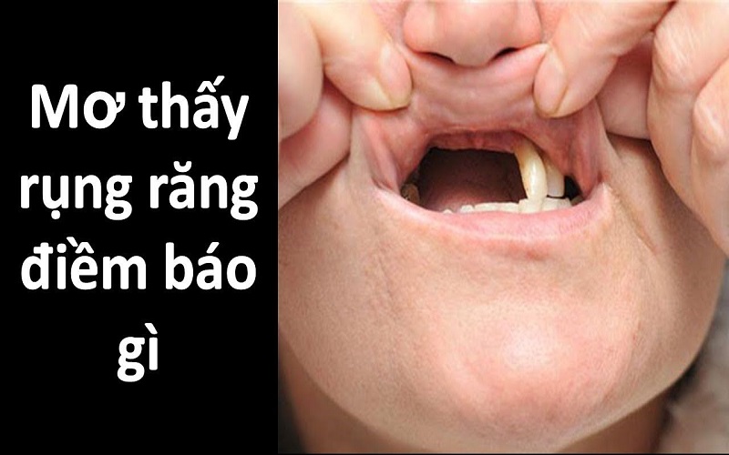 Giải mã giấc mơ rụng răng
